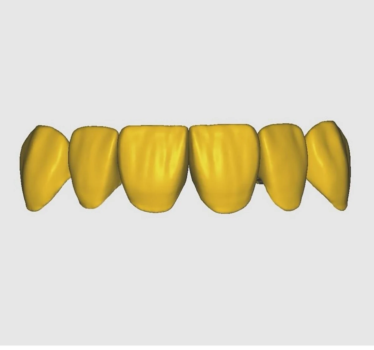 Yellow CAD rendering of six anterior tooth forms
