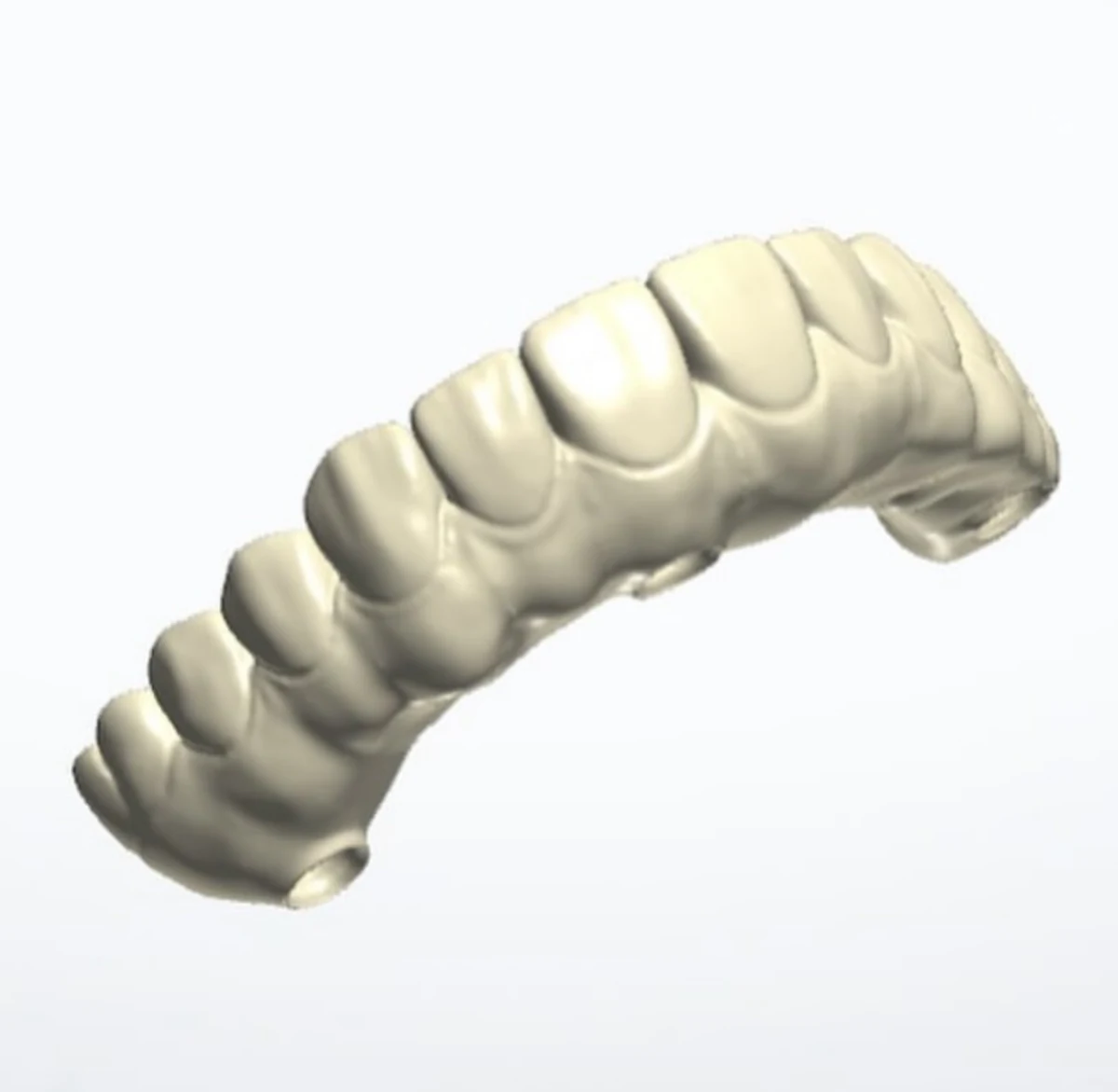 Oblique CAD view of a full-arch anterior restorative design